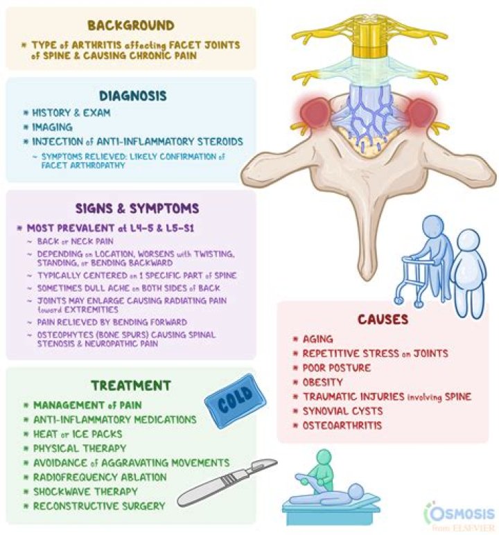 Facet Arthropathy Causes, Symptoms & Treatments